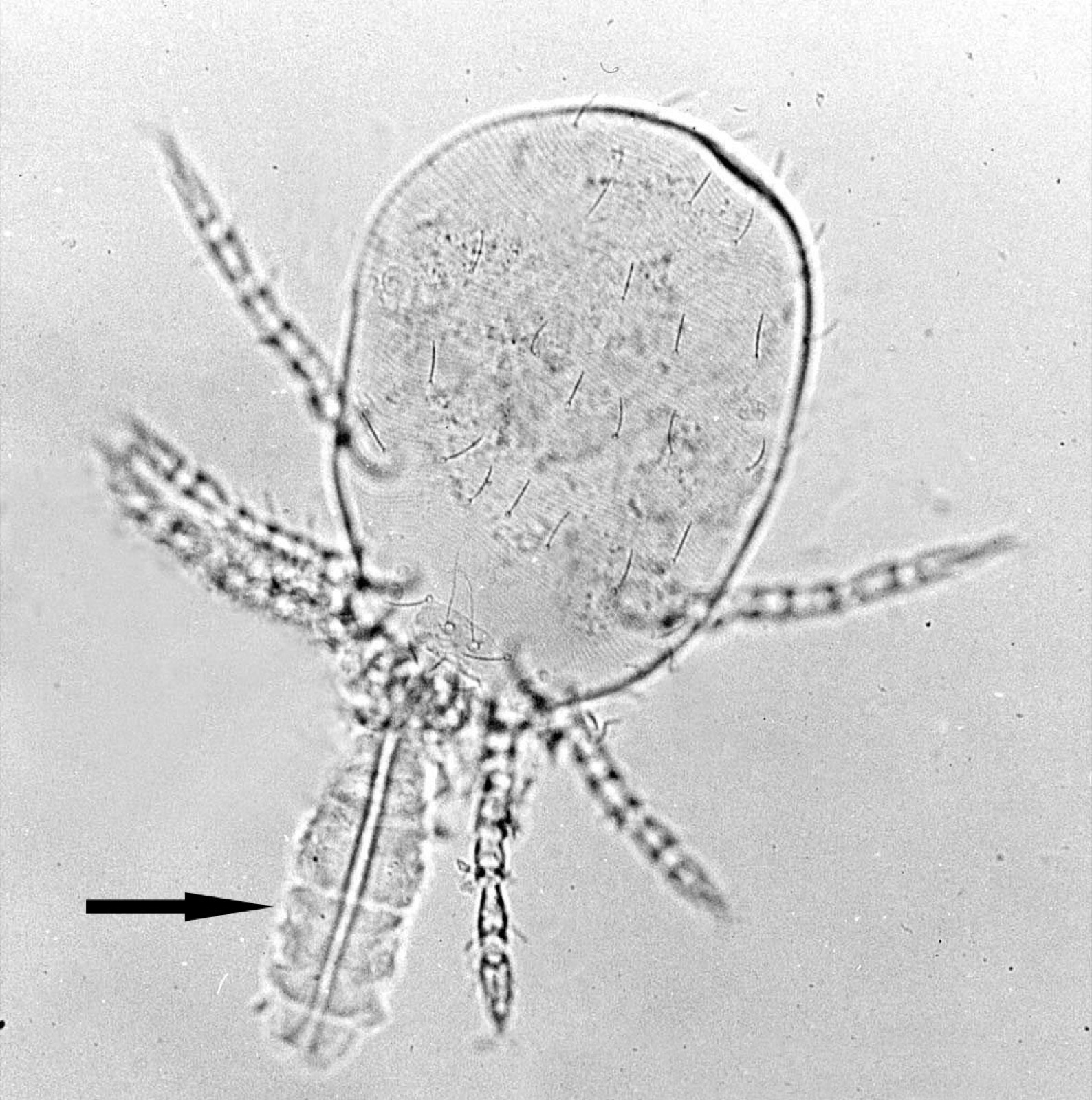 Micrograph of a chigger larva feeding through a stylostome tube in skin